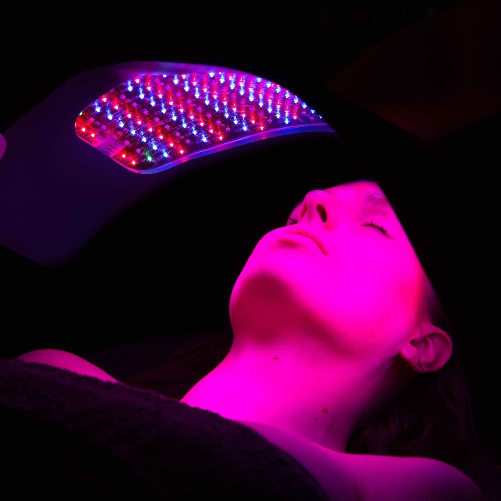 MO++light+therapy.